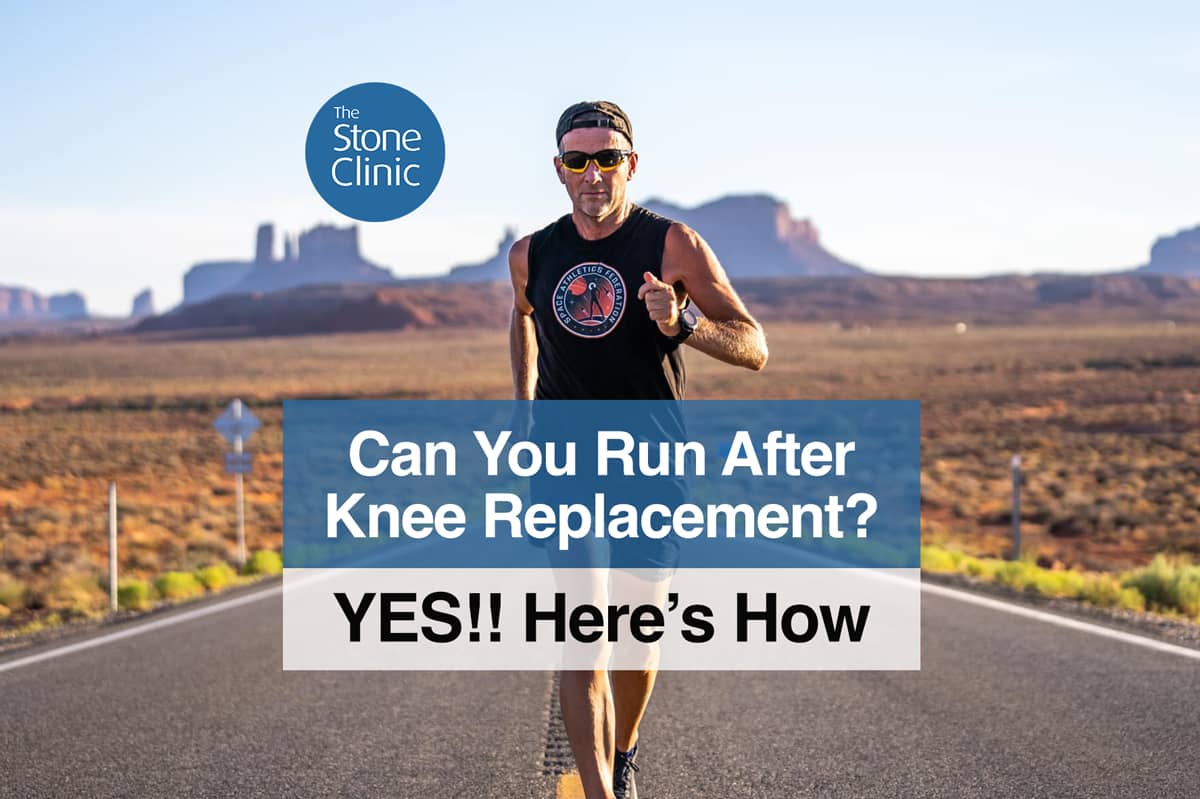 When Can I Start Running After Knee Replacement Surgery